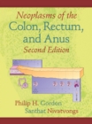 Image for Neoplasms of the colon, rectum, and anus