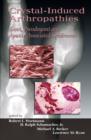 Image for Crystal-induced arthropathies: gout, pseudogout and apatite-associated syndromes