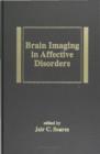 Image for Brain imaging in affective disorders