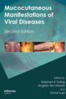 Image for Mucocutaneous Manifestations of Viral Diseases