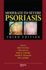 Image for Moderate-to-Severe Psoriasis
