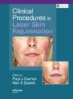 Image for Clinical procedures in laser skin rejuvenation