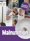 Image for Malnutrition