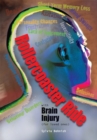 Image for Rollercoaster Ride with Brain Injury (For Loved Ones)