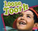 Image for Loose Tooth (Healthy Teeth)