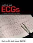 Image for Multiple Lead ECGs : A Practical Analysis of Arrhythmias