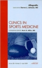 Image for Allografts, An Issue of Clinics in Sports Medicine