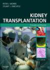 Image for Kidney transplantation: principles and practice
