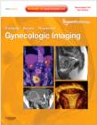 Image for Gynecologic Imaging