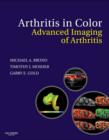 Image for Arthritis in color: advanced imaging of arthritis