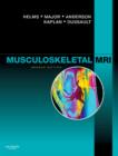 Image for Musculoskeletal MRI