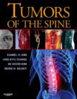 Image for Tumors of the spine