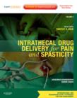 Image for Intrathecal Drug Delivery for Pain and Spasticity