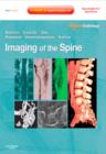 Image for Imaging of the spine