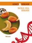 Image for Sickle cell disease