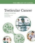 Image for Testicular cancer