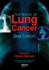 Image for Textbook of lung cancer