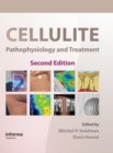 Image for Cellulite: pathophysiology and treatment. : 45