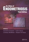 Image for An atlas of endometriosis.