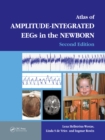 Image for Atlas of amplitude-integrated EEGs in the newborn