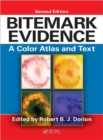 Image for Bitemark evidence