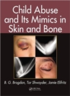 Image for Child Abuse and its Mimics in Skin and Bone