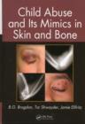 Image for Child abuse and its mimics in skin and bone