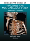 Image for Forensic pathology of fractures and mechanisms of injury: postmortem CT scanning
