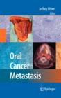 Image for Oral cancer metastasis