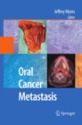 Image for Oral cancer metastasis