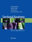 Image for Sectional anatomy  : PET/CT and SPECT/CT