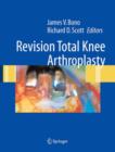 Image for Revision Total Knee Arthroplasty
