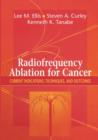 Image for Radiofrequency Ablation for Cancer : Current Indications, Techniques, and Outcomes