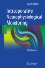 Image for Intraoperative neurophysiological monitoring