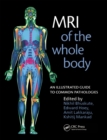 Image for MRI of the whole body: an illustrated guide to common pathologies
