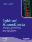 Image for Epidural anaesthesia  : images, problems and solutions