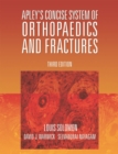 Image for Apley&#39;s concise system of orthopaedics and fractures.