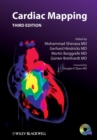 Image for Cardiac mapping.