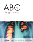 Image for ABC of lung cancer