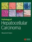 Image for Pathology of Hepatocellular Carcinoma