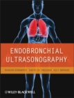 Image for Endobronchial Ultrasonography