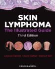 Image for Skin Lymphoma : The Illustrated Guide