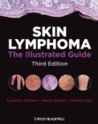 Image for Skin Lymphoma: The Illustrated Guide