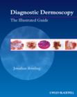 Image for Diagnostic Dermoscopy