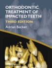Image for The orthodontic treatment of impacted teeth