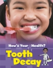 Image for Tooth decay