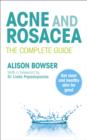 Image for Acne and rosacea: the complete guide