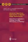 Image for Advanced Algorithmic Approaches to Medical Image Segmentation