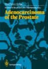 Image for Adenocarcinoma of the Prostate