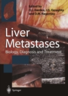 Image for Liver Metastases: Biology, Diagnosis and Treatment